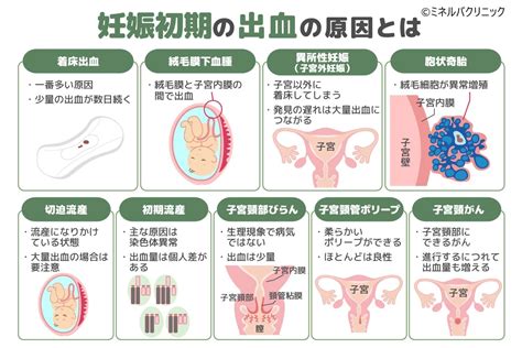 胎盤形成出血|妊娠初期に出血が起きる9つの原因とは？対処手順や。